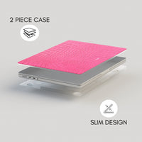 CHICLETE — MacBook Case